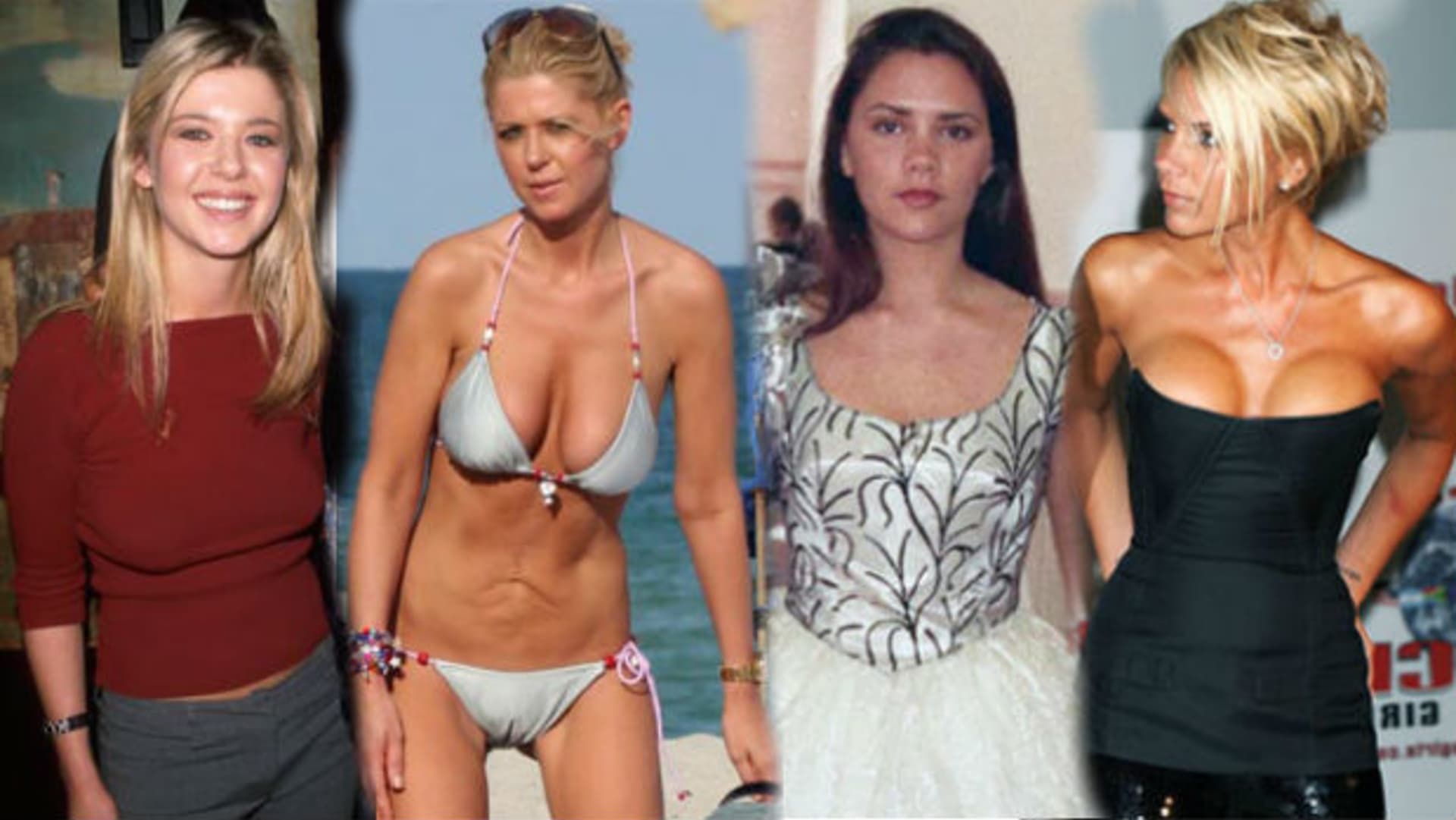 Plastická chirurgie se vymstila i kráskám jako Tara Reid a Victoria Beckham.