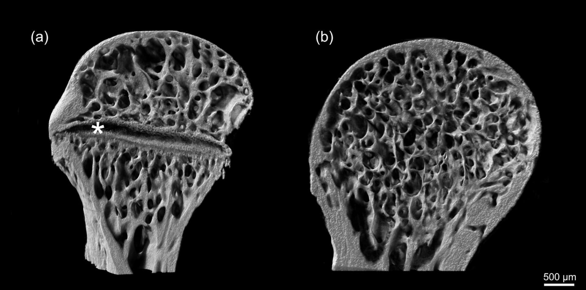 Podélný řez proximální epifýzou stehenní kosti zachycený pomocí rentgenové mikrotomografie s přítomnou (a) a resorbovanou (b) růstovou ploténkou. Hvězdička značí přítomnost růstové ploténky.