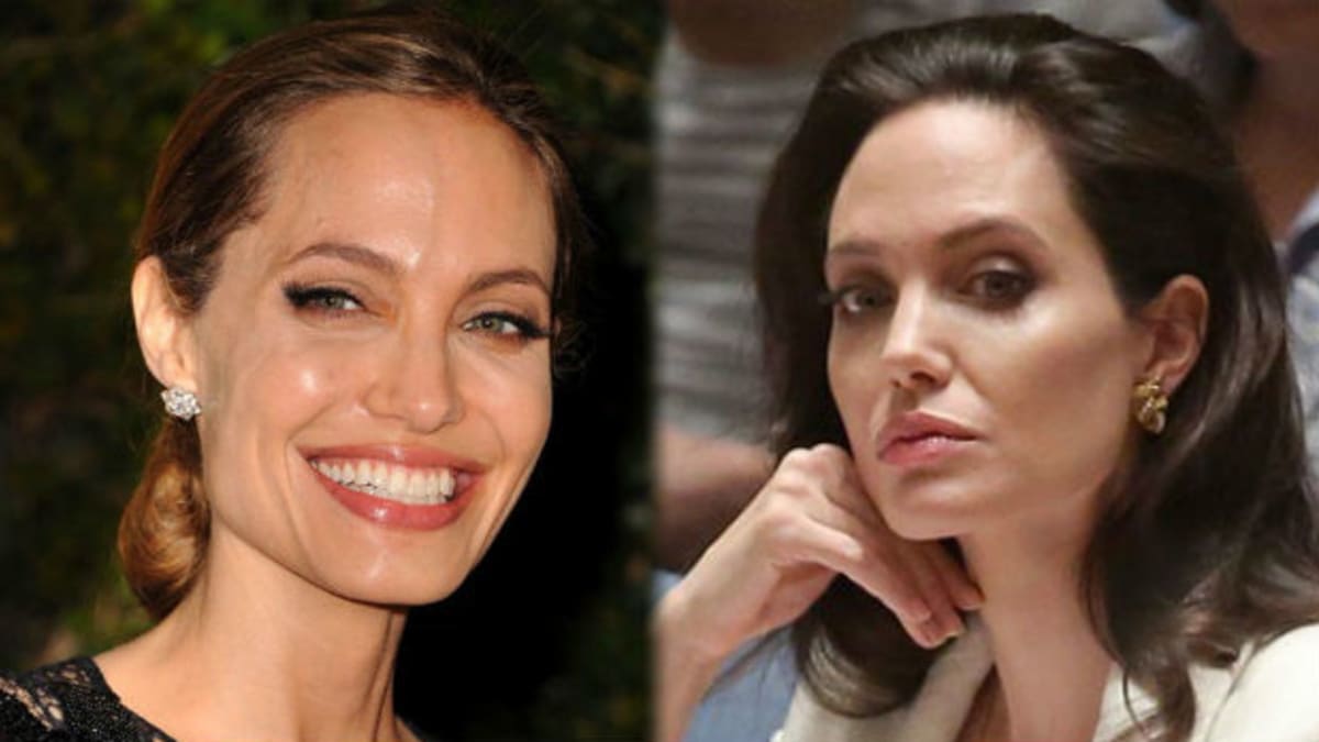 Angelina tvrdí, že žádné plastiky nikdy neměla, odbornice mají jiný názor.