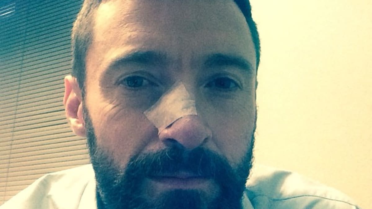 Zalepený nos po operaci si herec Hugh Jackman neváhal vyfotit a vyvěsit na sociální síť