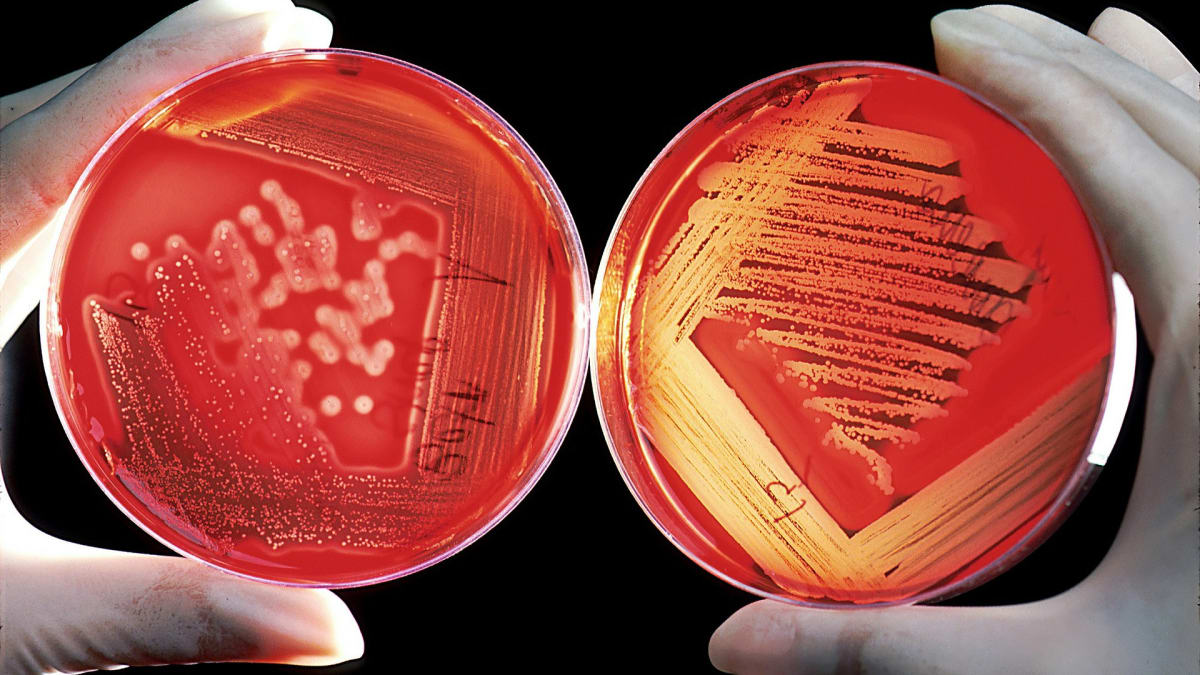 Hrozí nám návrat do éry před antibiotiky? (ilustrační foto)
