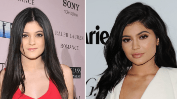 Proměny nejmladší Kardashianky. Jak se díky plastikám změnila Kylie?
