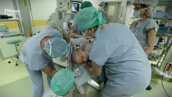 Lékaři z Nemocnice Motol zachránili dítě unikátní operací mozku