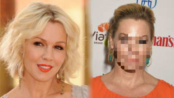 FOTO: Přebotoxovaná Kelly z Beverly Hills 90210 nepohne obličejem! Vypadá jako figurína!
