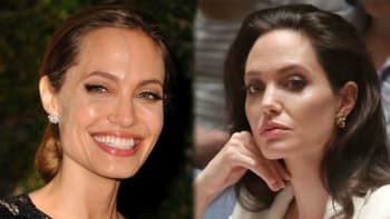 Angelino, KECÁŠ! Jolie zapírá plastiky, ale estetický chirurg její LEŽ odhalil!