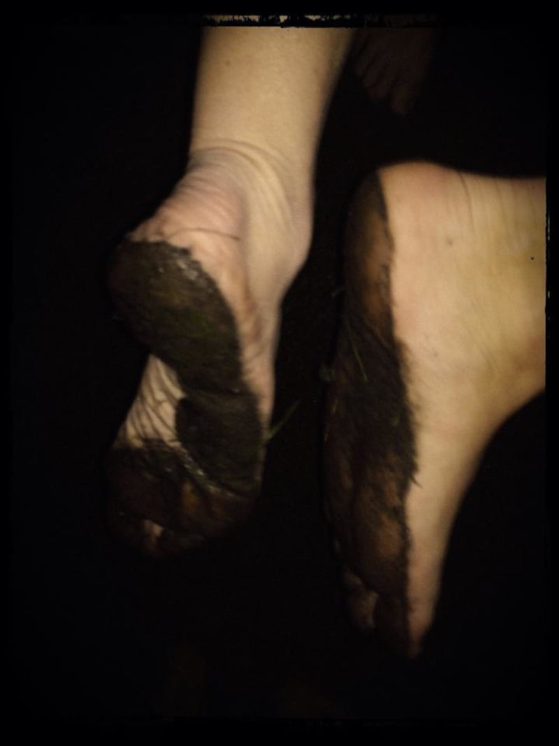Takto vypadají nohy, které přejdou žhavé uhlí