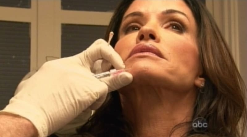 Janice Dickinson si nechává umrtvovat svaly obličeje botoxem