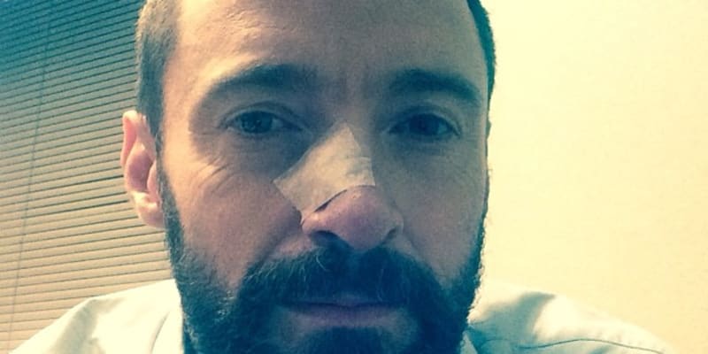 Zalepený nos po operaci si herec Hugh Jackman neváhal vyfotit a vyvěsit na sociální síť