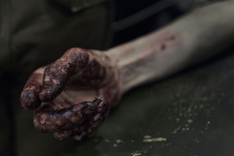 Zkrvavená ruka zraněného ukrajinského vojáka poblíž Bachmutu
