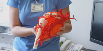 Úspěch lékařů z Brna. Vytvořili 3D model „podkožního nádoru“, podle něj pak dítě operovali