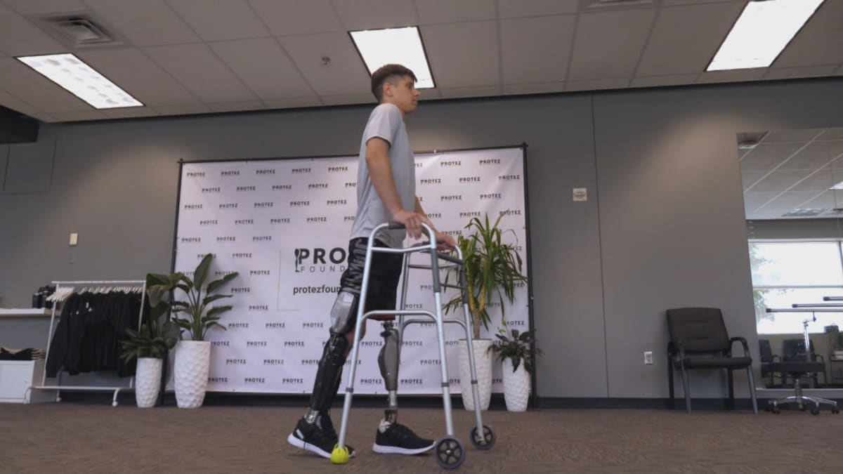 Sedmnáctiletý Arťom Svěrgon se znovu postavil na nohy díky pomoci nadace Protez