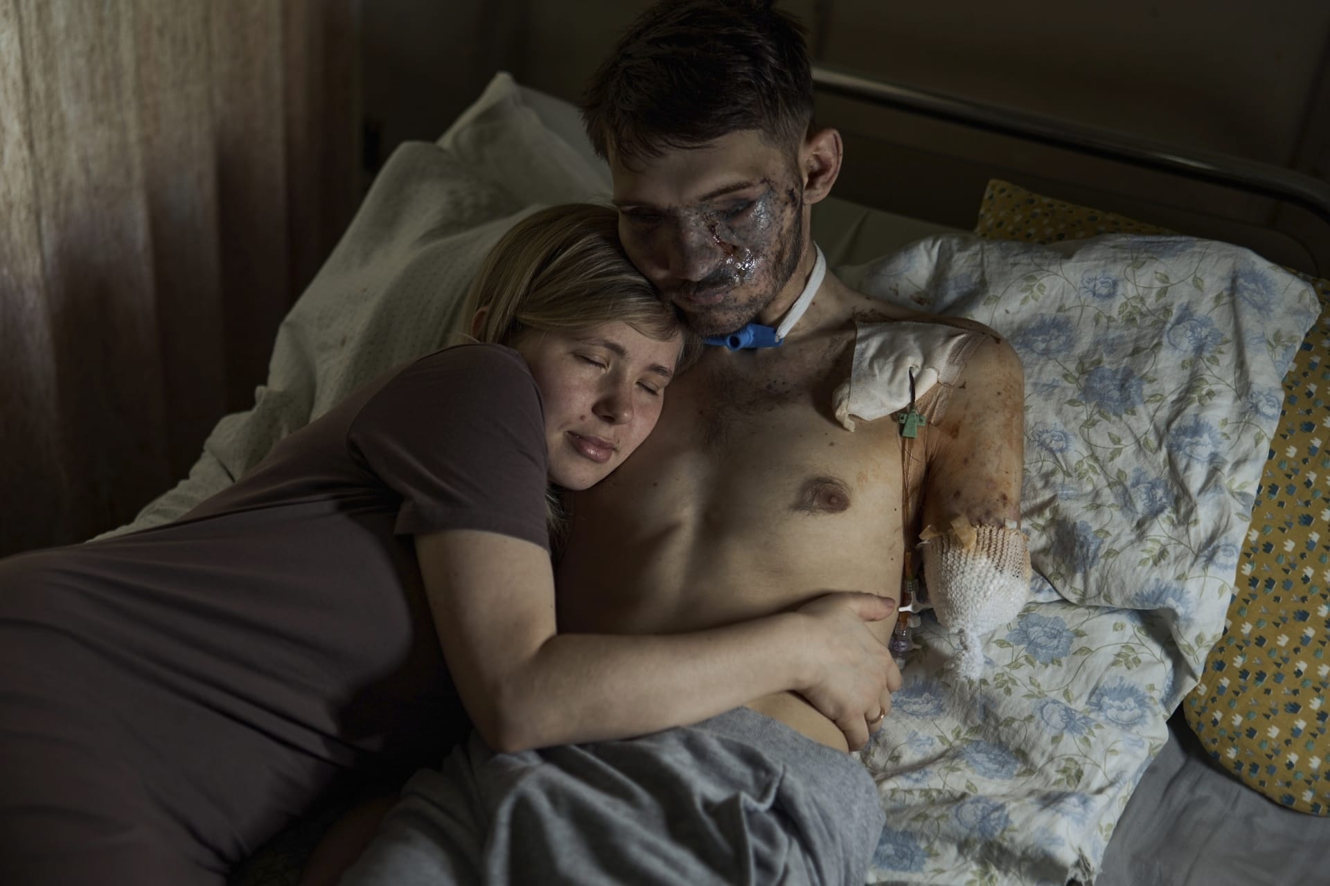 Alina v kyjevské nemocnici objímá svého manžela Andrije, který utrpěl těžká zranění během bojů s Rusy v Záporožské oblasti