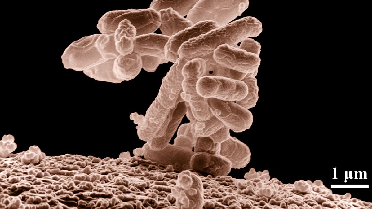 Bakterii Escherichia coli, známou také jako E. coli, čínští vědci využili jako základ nového kmene, který ničí rakovinové nádory.