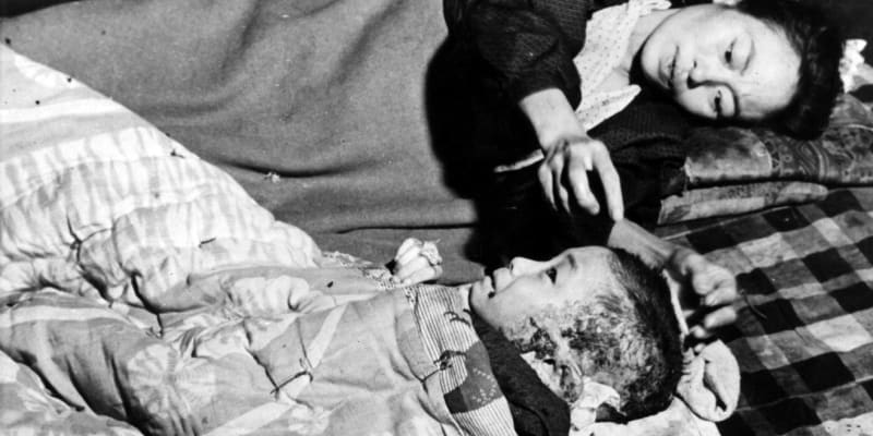 Atomová bomba Little Boy zabila 6. srpna 1945 přes 70 tisíc lidí. Stejný počet zemřel v následujících letech
