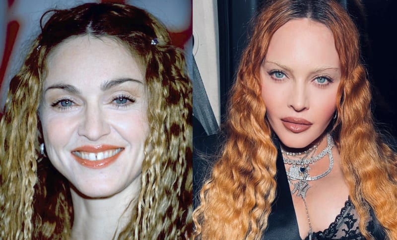 Madonna v roce 1998 (vlevo) a 2022. Zpěvačka se na první pohled změnila k nepoznání.