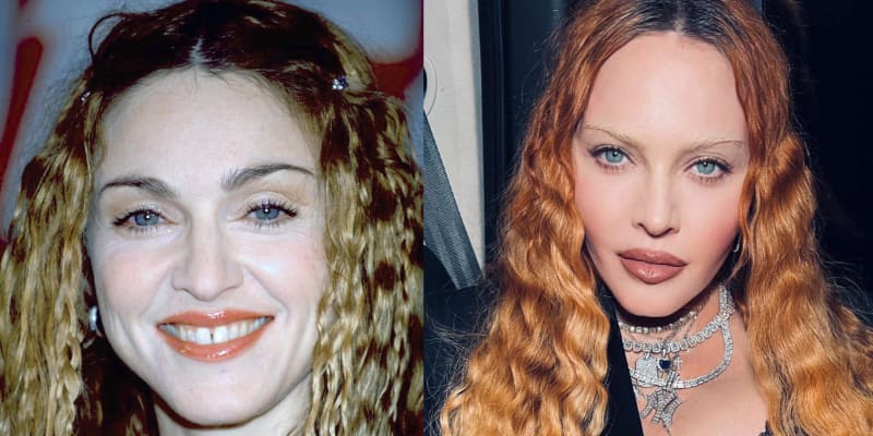Madonna v roce 1998 (vlevo) a 2022. Zpěvačka se na první pohled změnila k nepoznání.