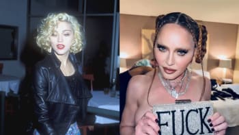 Madonna se nechce smířit se stárnutím. Děsí oteklým obličejem, kompenzuje to nahotou