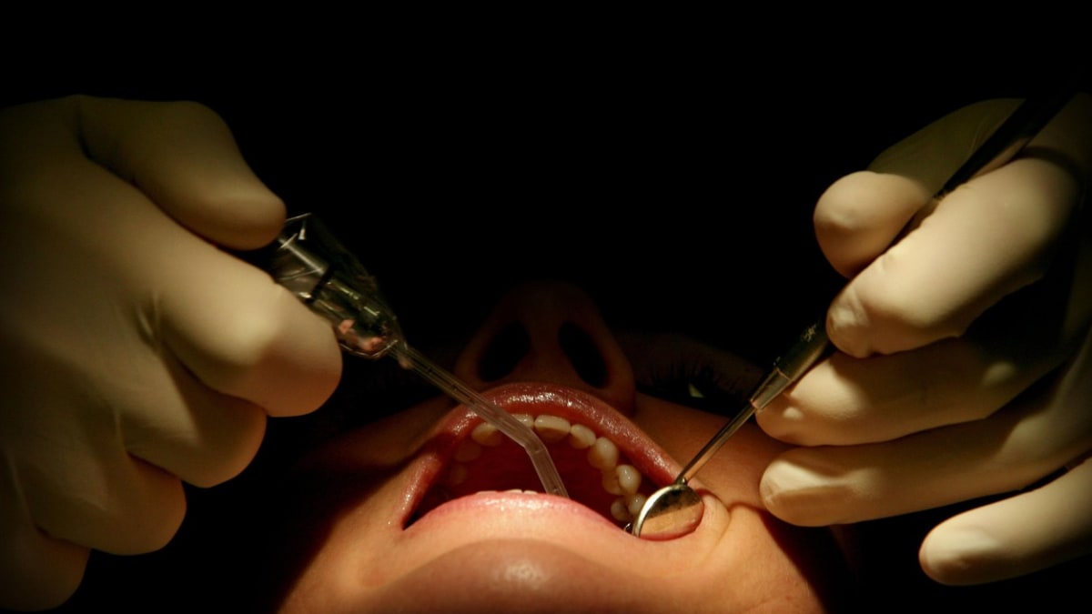 Žena zemřela po vytrhnutí zubu. Zubař měl falešný diplom a zdravotní sestra byla švadlena
