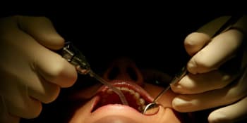 Ordinace hrůzy: Žena zemřela po trhání zubu. Lékař měl falešný diplom a sestra byla krejčová