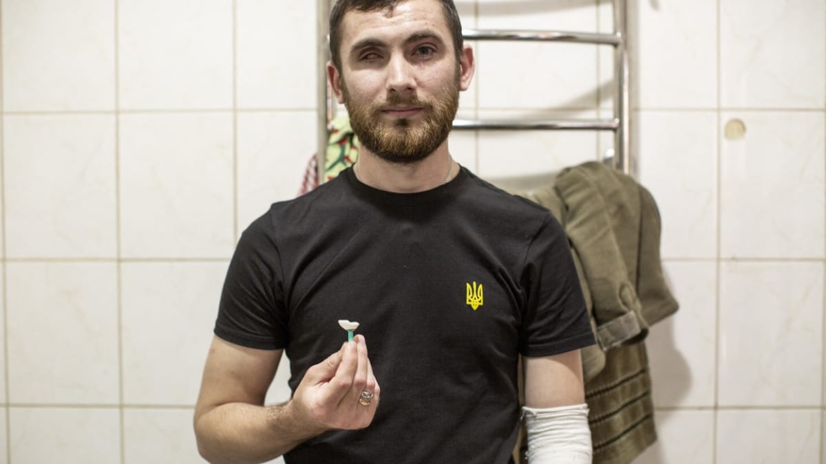 Ukrajinský veterán, který v bojích přišel o oko.