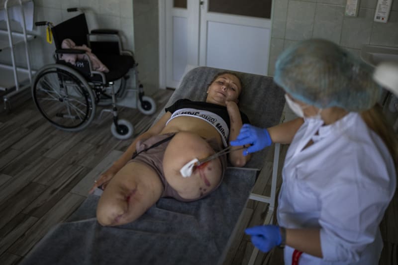 Ukrajinská žena zmrzačená ruským útokem