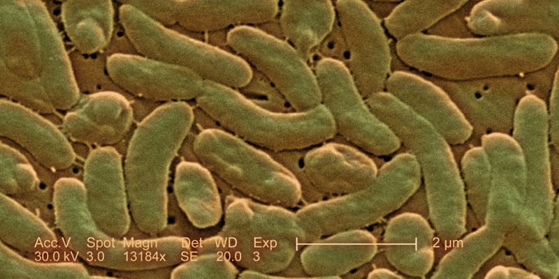 Bakterie Vibrio vulnificus může člověka ohrozit na životě.