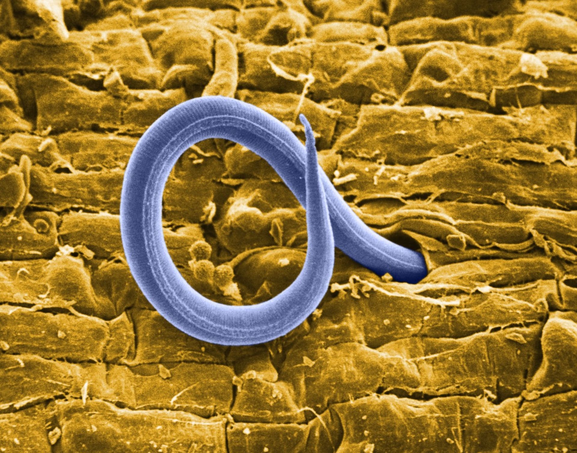 Sekret hlístice ophidascaris robertsi  dokáže rozložit orgánové tkáně