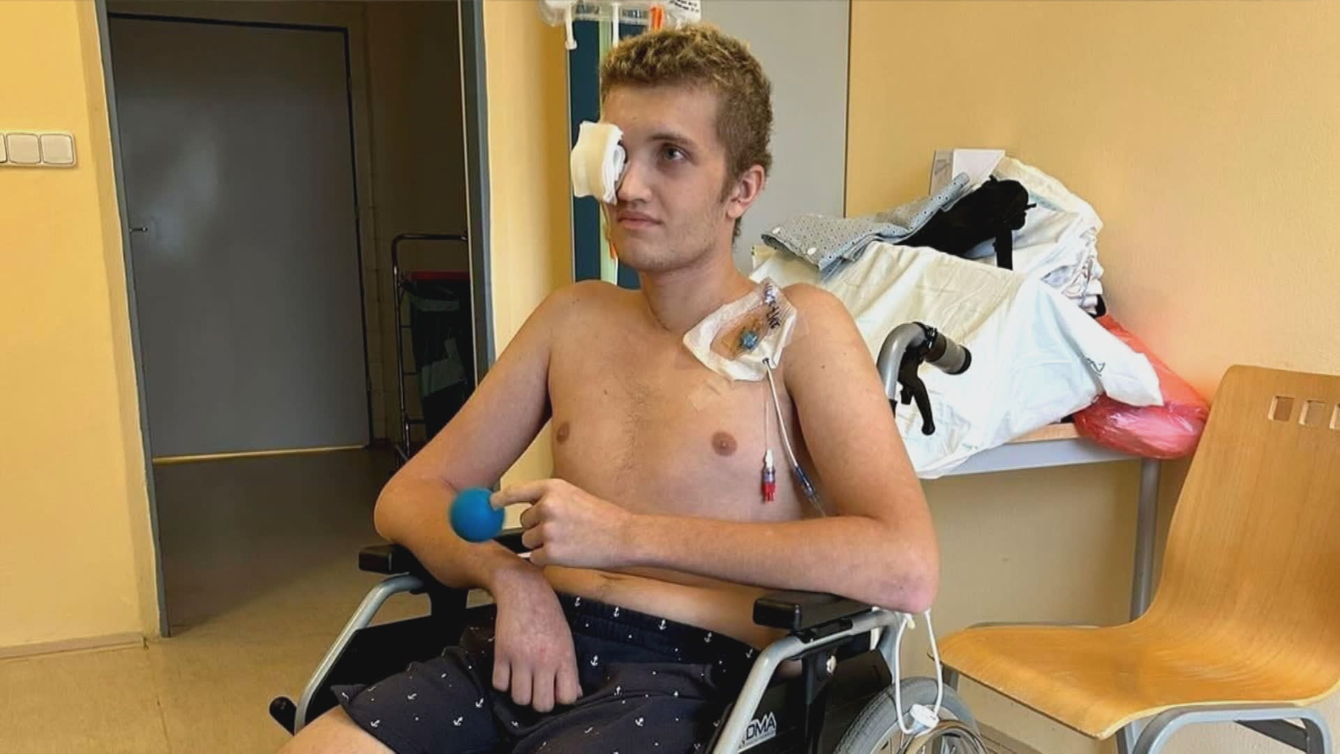 Sedmnáctiletý Tomáš přišel kvůli planým neštovicím obě nohy.