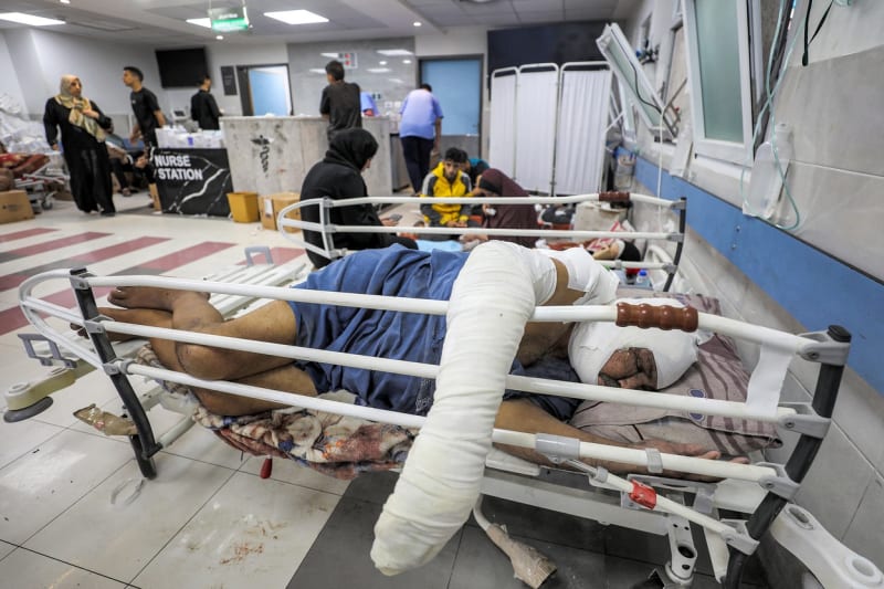Situace v nemocnicích v Gaze je kritická.