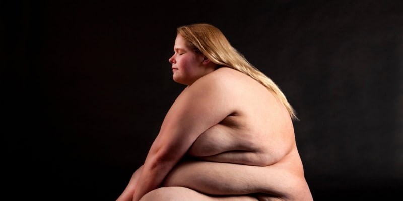 v USA hovoří o epidemii obezity