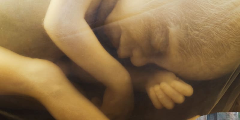 Dítě v děloze (ilustrační foto)