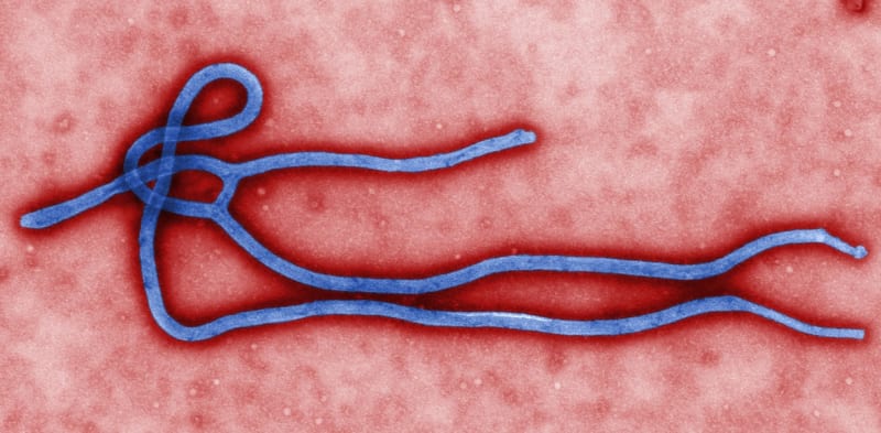 Ebola je jednou z nejsmrtelnějších zoonóz