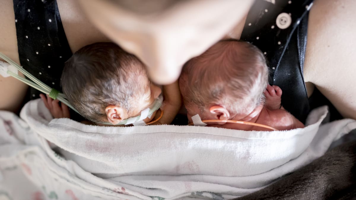 Dvojčata narozená v odlišný den i rok jsou neobvyklou událostí (ilustrační foto) 