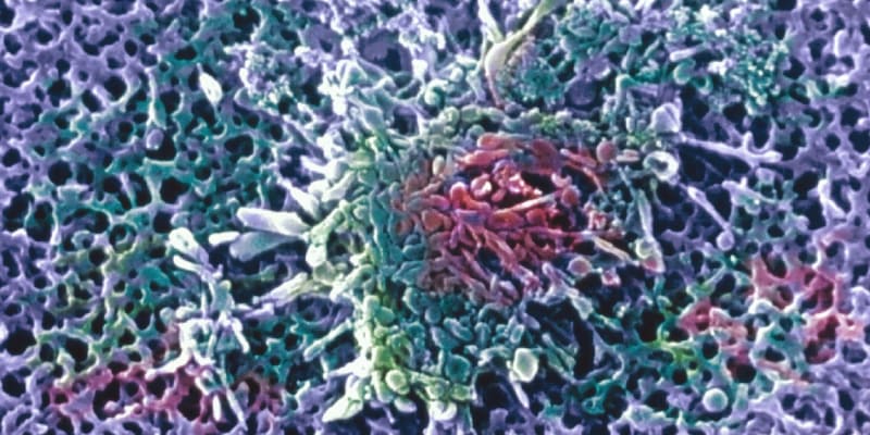 Bakterie mycoplasma pneumoniae, která onemocnění způsobuje