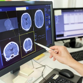 Počítačová tomografie umožňuje zobrazit různé části mozku pomocí rentgenového záření a následné počítačové rekonstrukce.