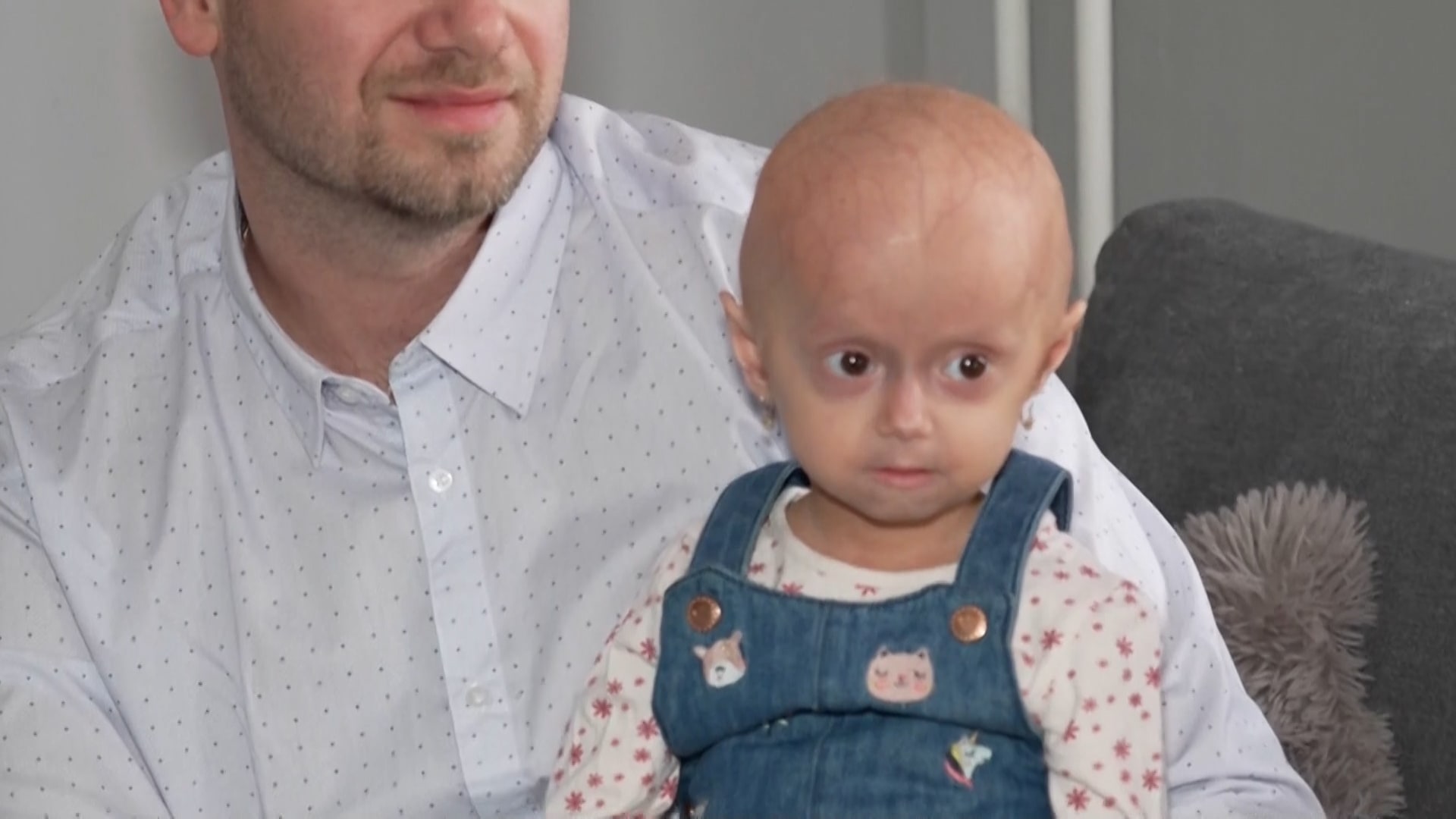 Adélka trpí vzácnou genetickou poruchou zvanou progerie.