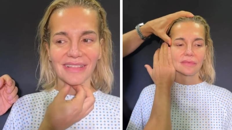 Pravda o obličeji Dary Rolins: Plastický chirurg ukázal video a řekl, co vše vylepšil