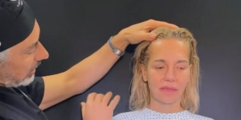 Plastický chirurg zveřejnil video před operací Dary Rolins.
