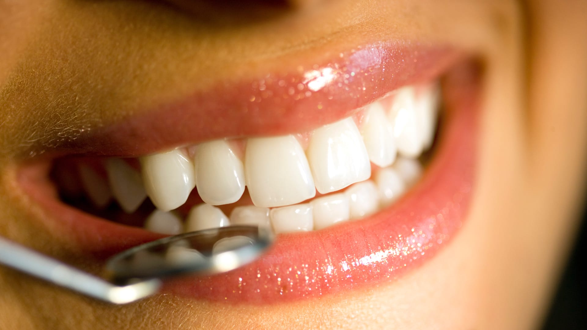 Problému s obrušováním zubů si často můžete všimnout až ve chvíli, kdy je pozdě.