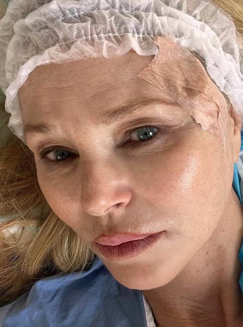 Modelka Christie Brinkleyová ukázala snímky po zákroku, při němž jí byl odstraněn nádor. 