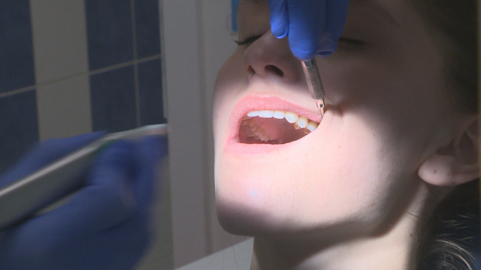 Češi jsou podle stomatologa Radoslava Laciny v přístupu k zubní hygieně spíše laxní. 