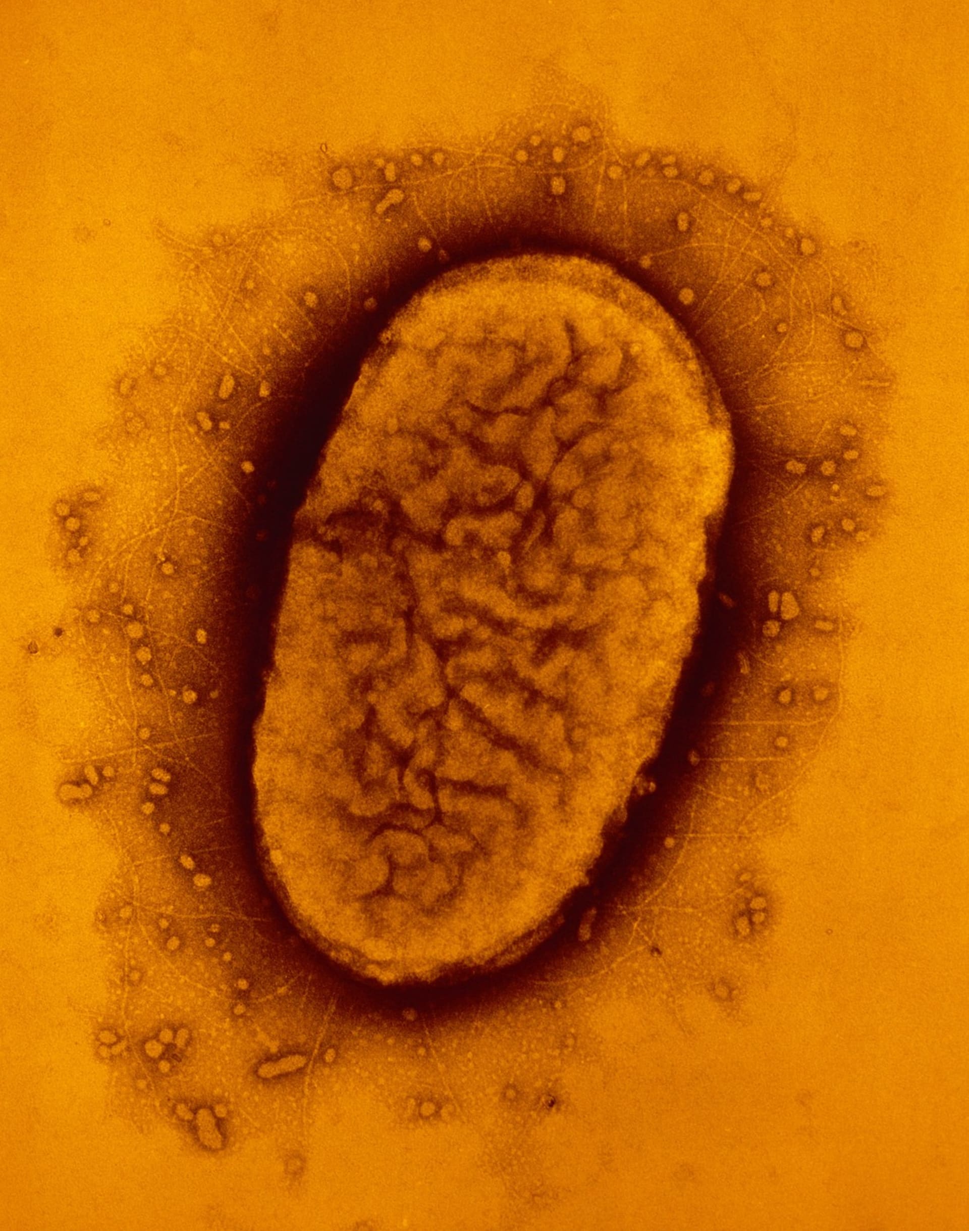 Původcem černého kašle je bakterie Bordetella pertusis