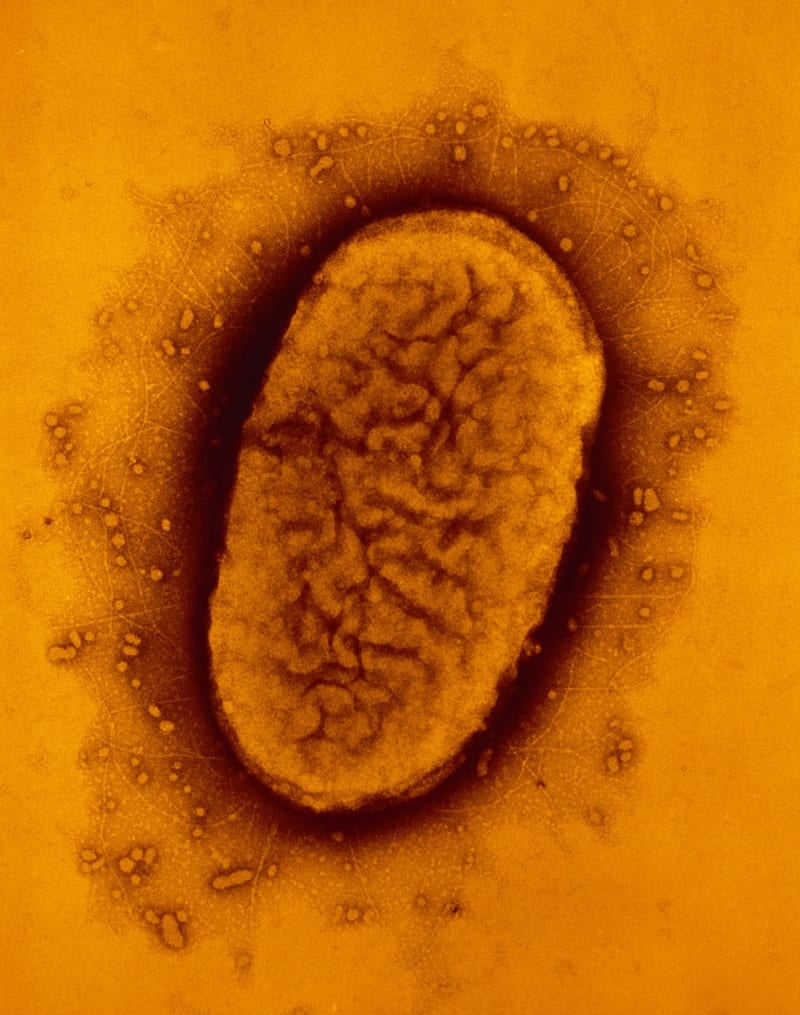 Původcem černého kašle je bakterie Bordetella pertusis