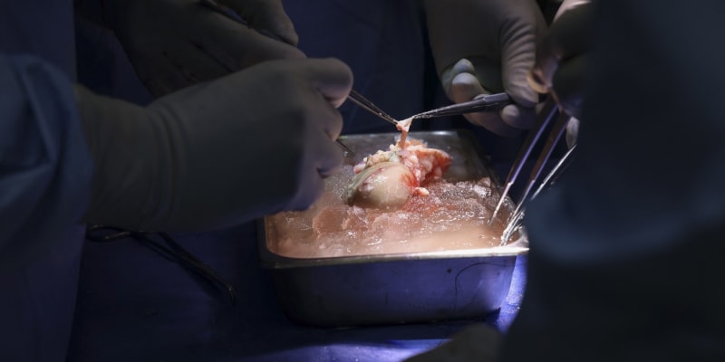 Lékaři z Bostonu transplantovali pacientovi ledvinu z geneticky upraveného prasete.