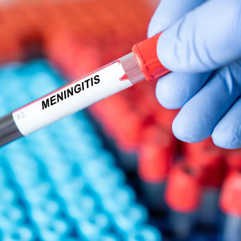 V USA přibývá případů onemocnění meningitidou. 