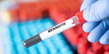 Počet pacientů nakažených meningitidou roste, varují lékaři. Jaké jsou příznaky a co vás ochrání?