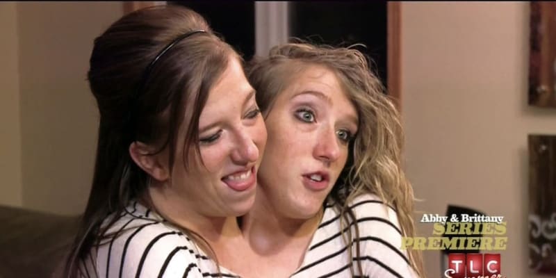 Siamská dvojčata Abby a Brittany Hensel popsala svůj intimní život