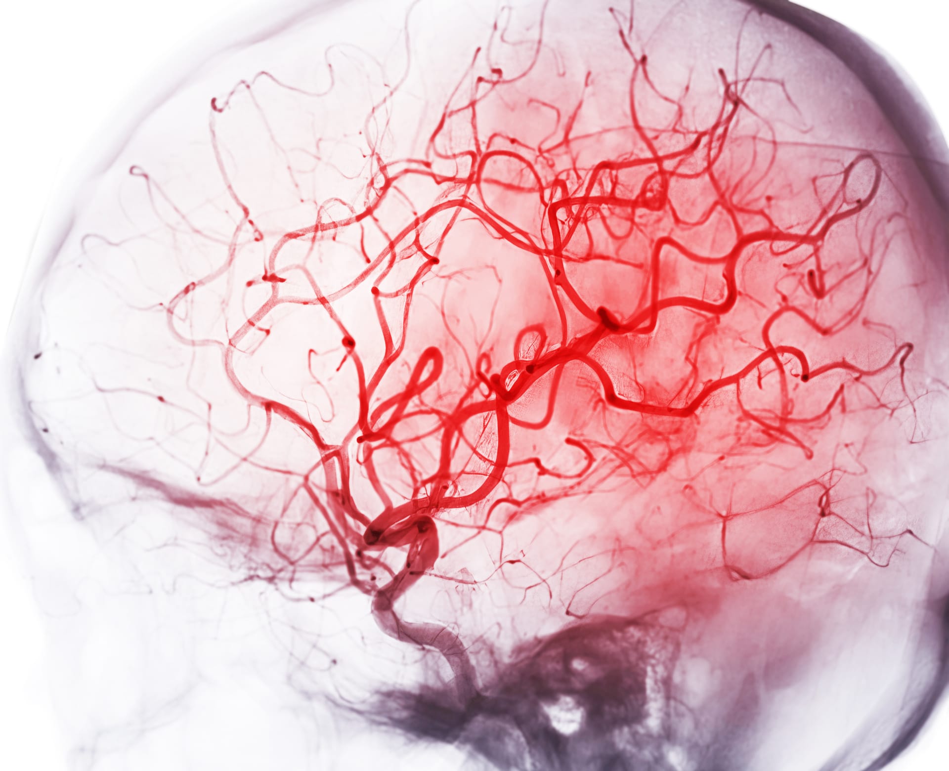 Lidský mozek je citlivý na nedostatek okysličené krve
