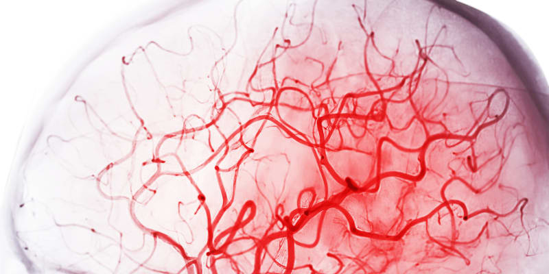 Lidský mozek je citlivý na nedostatek okysličené krve