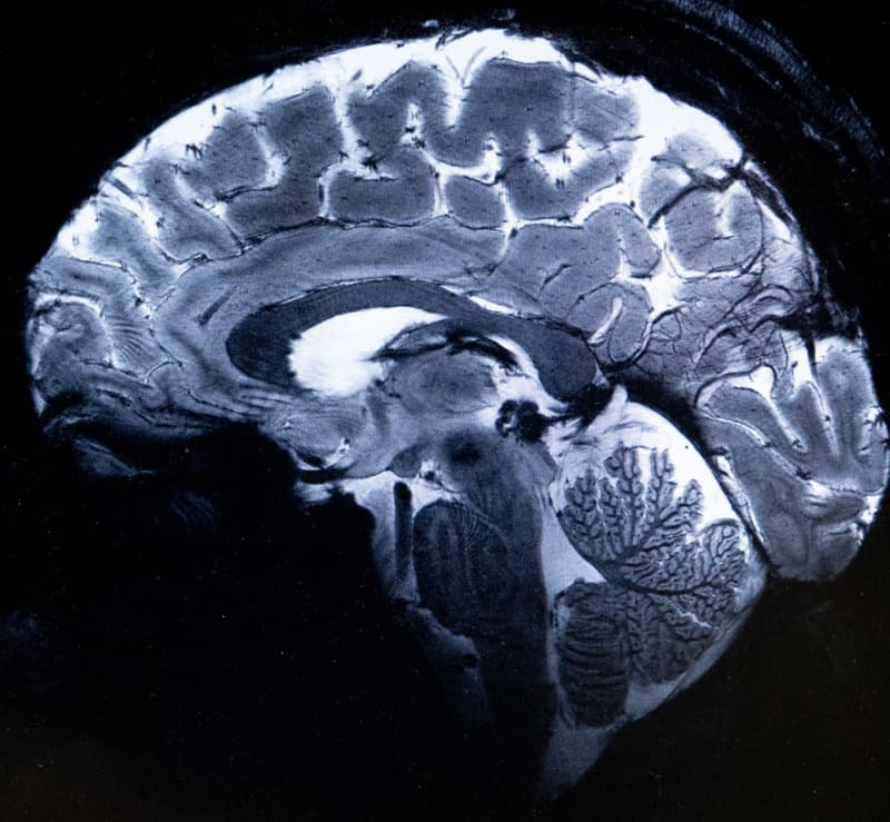 Nejdetailnější MR snímek mozku, který kdy kdo pořídil 